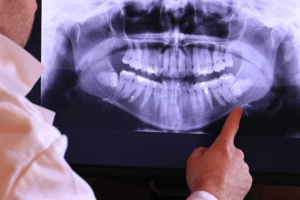 Best After-Hours Emergency Dentist in New Rockford, ND