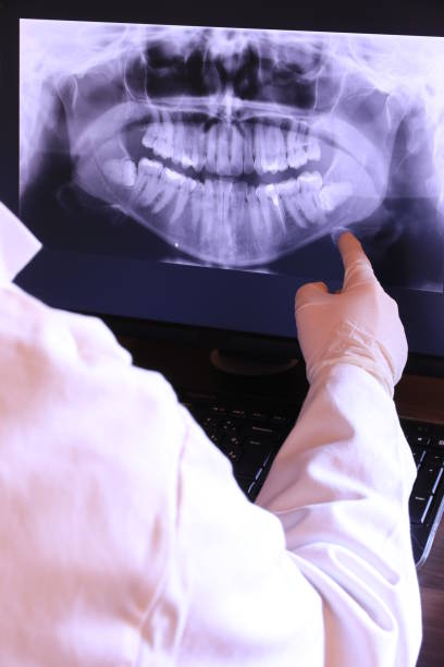 Best Emergency Broken Tooth Repair in New Rockford, ND