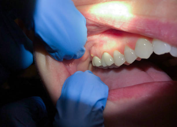 Best Emergency Treatment for Toothache in New Rockford, ND