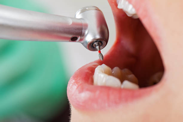 Best Emergency Treatment for Toothache in New Rockford, ND